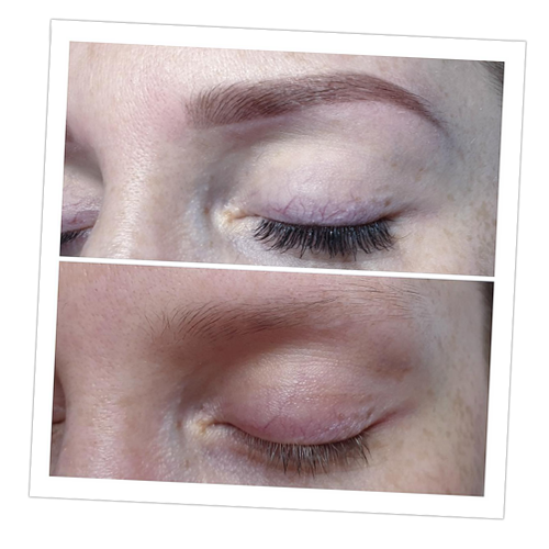 Before and After - Agnes dos Santos 03 Before and After - Agnes dos Santos 03